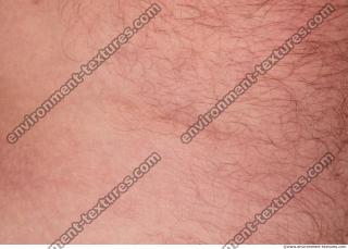 Photo Textures of Human Skin